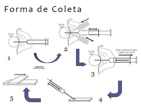 Formas de coleta de citologia