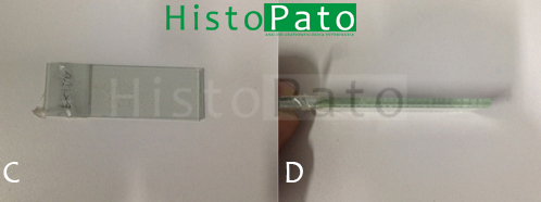 Lâminas sobrepostas – destruição celular